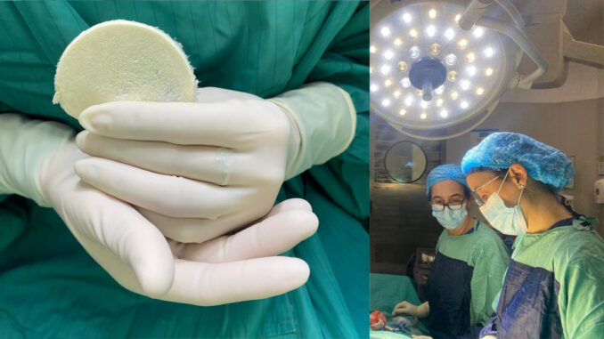 Con parches de placenta humana, logran cicatrizar una herida compleja